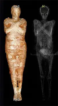 Mummy of pregnant woman