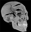 Seqenenre Tao II skull